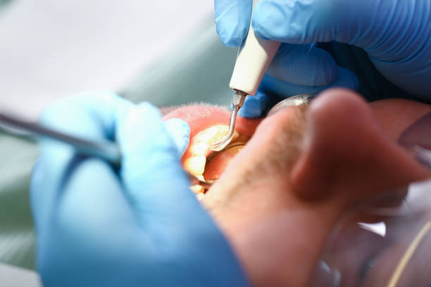 Best Tooth Pain Emergency Relief  in Pottsgrove, PA