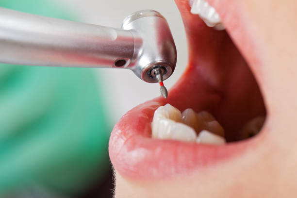 Best Root Canal Emergency Dentist  in Pottsgrove, PA